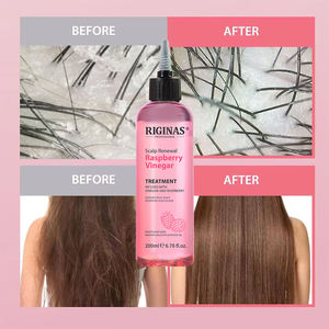 RIGINAS Perawatan Profesional Penyegar Kulit Kepala dengan Cuka Raspberry untuk Kulit Kepala Gatal dan Rambut Berkilau 200ml Label Pribadi - Product Image 3