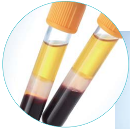 หลอดเก็บตัวอย่างเลือดสุญญากาศสำหรับโรงพยาบาลสารกระตุ้นก้อนเจลแยกออกจากกันสีเหลือง - Product Image 5
