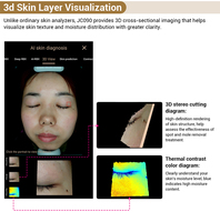 Analyseur de peau portable pour l'écosystème Apple iOS, machine d'analyse de la peau du visage