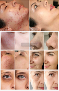 Appareil de beauté multifonctionnel 9 en 1 pour le traitement de l'acné, le jet d'eau oxygénée, le raffermissement et le rajeunissement de la peau, machine de beauté faciale fractionnée - Product Image 6