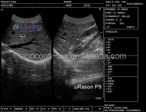 Lannx Urason P9 Volledig Gevulde Echografie Laptop Zwart/Wit Digitale Instrumenten Ultrasoon Ultrasoon Diagnostisch Apparaat
