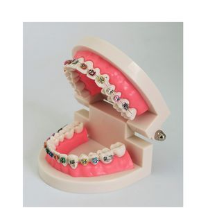 Modelo de dientes de ortodoncia dental con soporte de metal - Product Image 3