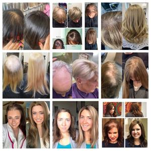 شعر مستعار أوروبي ريمي عذراء، قطعة علوية كبيرة الحجم 10x10 بدانتيل أمامي، قطع شعر علوية من شعر بشري طبيعي كامل الكثافة للنساء - Product Image 5