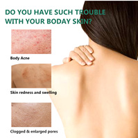 SAUVASINE fondu marque d'acné soins de la peau corps dos poitrine traitement de l'acné sérum fermeture de l'acné apaiser les Pores rétrécissement Spray soins de la peau