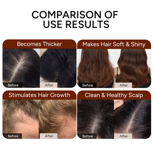 Kit de Soins Capillaires 2-en-1 à l'Argan, Romarin et Batana : Croissance, Réparation, Épaississement, Hydratation, Anti-Chute, Nourrissant, Lissant et <span class=keywords><strong>Cheveux</strong></span> Sains - Product Image 4