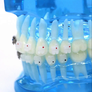 AMAIN Tooth Braces Dental ortodoncia soporte de ortodoncia China Braces ortodoncia - Product Image 5