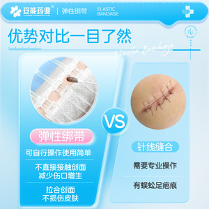 ผ้าพันแผลยืดหยุ่นแบบซิป Compromise Elastic Bandage Tb-2 ขนาด 40 มม. สำหรับลดแรงกดบริเวณแผล ช่วยสมานแผลหลังผ่าตัดโดยไม่ต้องเย็บ - Product Image 4