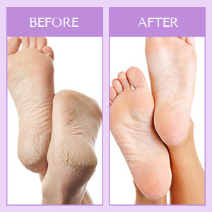 Venta al por mayor de oro nutritivo hidratante mascarillas para pies colágeno 24K hidrogeles gelatina cuidado de la piel seca mascarilla para pies belleza - Product Image 3