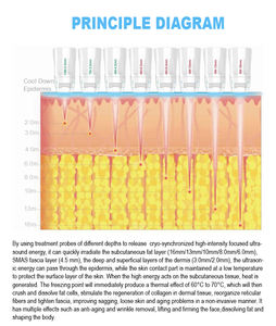 सबसे ज्यादा बिकने वाली वसा भंग शरीर को आकार देने वाली मशीन बर्फ शीतलन प्रणाली चेहरे को सख्त और मजबूत करने वाली त्वचा वी अधिकतम डिवाइस - Product Image 4