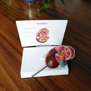 Modelo anatómico de enseñanza de ciencia médica, modelo de disección de riñón humano, modelo educativo de órganos, estructura anatómica de riñón - Product Image 5
