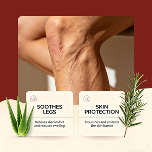 Wholesale Gentle Ingredients Daily Body Care Reduces Discomfort Nourishing Soothing Moisturizing <strong>Varicose</strong> <strong>Veins</strong> <strong>Relief</strong> <strong>Cream</strong> - Product Image 3