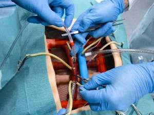 Simulateur de réalité virtuelle Bakulev CPBSS pour la formation scientifique médicale avec mannequin - Product Image 4