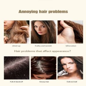 Champú orgánico anticaspa, limpia profundamente, alivia la picazón, elimina la caspa, calma el cuero cabelludo, fortalece las hebras del <span class=keywords><strong>cabello</strong></span> - Product Image 5