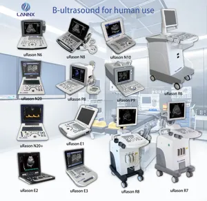 LANNX uRason E2 Muy popular Hospital portátil echographe ecografo instrumento de ultrasonido color ultrasónico digital portátil USG