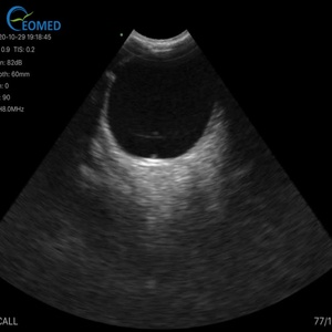 Échographe portable sans fil CU110 Wifi, scanner à ultrasons couleur Doppler, machine d'échographie sans fil - Product Image 3