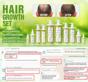 Custom Organic Tea Tree <span class=keywords><strong>Oil</strong></span> Cebola e Alecrim Hair Care Crescimento Shampoo Biotina Herbal Shampoo e Condicionador Set Private Label - Product Image 4