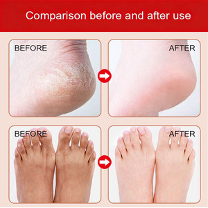 Sal de Baño de Cristal de Mar Muerto con Rosa Natural Pura, Gel Exfoliante para Pies, Paquete de Cuidado Corporal - Product Image 6