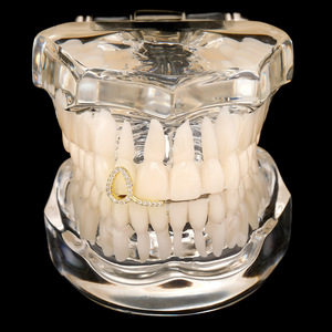 Grillz en forme de goutte d'eau dorés avec incrustation de zircon pour fête, accessoire de style hip-hop unisexe - Product Image 1