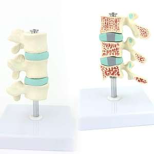Gelsonlab HSBM-139 Tulang Belakang Model Anatomi, Model Osteoporosis, Ntervertebral Disc Model Perut Ortopedi Nyeri Model - Product Image 3