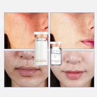 Masque anti-rides OEM Mummy Face Witch pour le front, soin de la peau à la vitamine E, masque visage en V, masque enzymatique en poudre au collagène