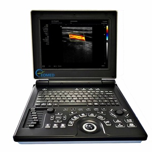 Système de diagnostic ultrasonore Doppler couleur entièrement numérique CU20, appareil d'échographie médicale portable - Product Image 1