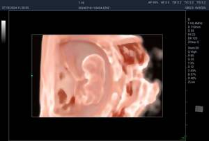 의료 영상 및 심장 스크리닝을위한 휴대용 3D/4D 산과 초음파 기계 - Product Image 5