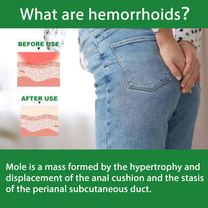 Spray de 30 ml para Aliviar la Picazón Anal, el <span class=keywords><strong>Dolor</strong></span> <span class=keywords><strong>Rectal</strong></span>, la Hemorragia, el Prolapso y las Nódulos de Carne, para <span class=keywords><strong>Hemorroides</strong></span> Internas y Externas - Product Image 5