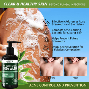 Hot Sales Mens Shower Gel Peppermint Tea Tree Bath Gel Iquid <strong>Soap</strong> Antibacterials <strong>Anti</strong> <strong>Fungal</strong> Body Wash - Product Image 5