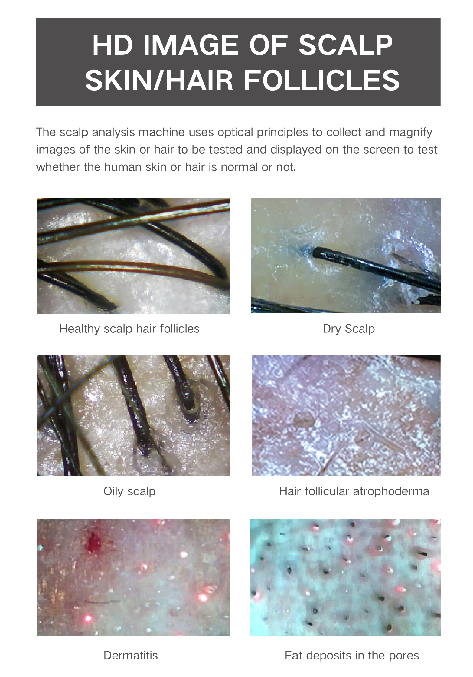 analysis machine,hair analyser machine,hd screen hair follicle