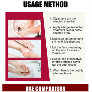 OEM Perfectx crema corpo controdolore 100g articolare valgo articolare dolore muscolare al ginocchio unguenti 50g massaggio 15 minuti crema al collagene - Product Image 6