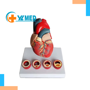 Model Patologi Jantung Pabrik, Model Jantung Penyakit, Model Penyakit Jantung Aterosklerosis Koronari - Product Image 1