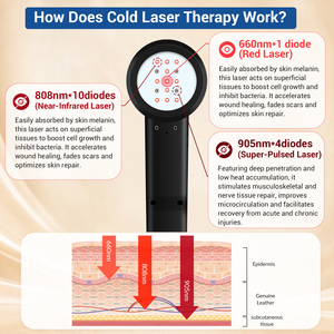 Thérapie laser pour entorse de la cheville et arthrite chez l'homme, arthrite près de chez moi, 905 nm 305 W, rééducation des entorses et des inflammations articulaires - Product Image 4