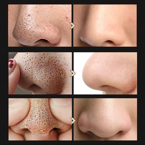 <span class=keywords><strong>BREYLEE</strong></span> Set 2 en 1 para Puntos Negros: Mascarilla Nasal con Extracto de Árbol de Té + Serum Líquido Original para Puntos Negros en Caja - Product Image 6