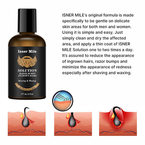 San fero — liquide de traitement pour la perte de cheveux, produit de rasage, traitement rapide en forme de goutte d'huile - Product Image 2
