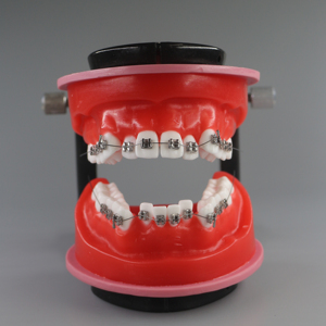 Modèle de typodont dentaire ciré pour orthodontie, pratique orthodontique - Product Image 4