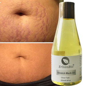 Kualitas tinggi stretch mark minyak esensial persentase ekstrak alami mengurangi bekas luka kerutan penghilang tanda kerutan minyak - Product Image 4