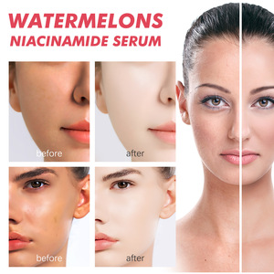 Sérum hydratant éclaircissant pour la peau, raffermissant et éclaircissant, essence de pastèque niacinamide - Product Image 5
