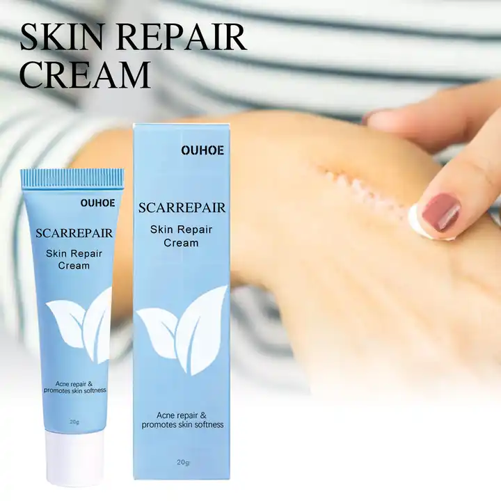BREYLEE Herbal Acne Scar Removal Cream| Alibaba.com