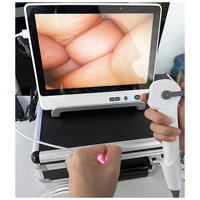 SY-P029-3 Endoscope de haute qualité Uretero-Renoscope Urologie Ureteroscope vidéo flexible à usage unique Ureteroscope jetable
