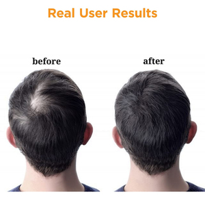 Tabletas para el Crecimiento del Cabello con Complejo Marino OEM/ODM, Multi-beneficios para la Defensa Contra la Caída del Cabello y Reparación del Cabello Seco, Áspero y Dañado - Product Image 3