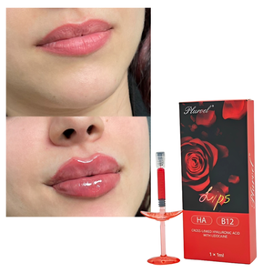 Produit le plus vendu : Remplisseur cutané monophasé en HA réticulé avec VB12 pour lutter contre les rides et augmenter le volume des lèvres - Product Image 1