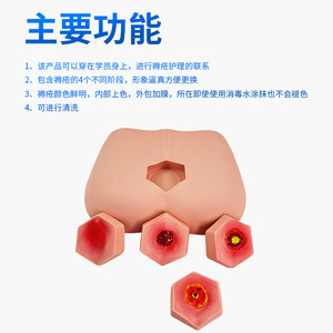 Modèle de soins des escarres à pression en plusieurs étapes, modèle pédagogique pour les soins aux personnes âgées et modèle de formation aux soins des escarres à pression en quatre étapes - Product Image 2