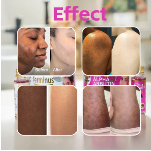 Savon Liquide Corporel OEM Bio au Glutathion et à l'Arbutine, Nettoyant en Profondeur, Blanchissant, à la Glycérine, pour Éclaircir les Jointures et les Zones Sombres des Bras, Idéal Peaux Grasses - Product Image 5