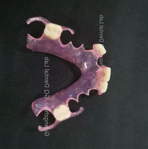 <span class=keywords><strong>Prothèse</strong></span> <span class=keywords><strong>dentaire</strong></span> flexible Valplast <span class=keywords><strong>Prothèse</strong></span> <span class=keywords><strong>temporaire</strong></span> sans meulage des dents, pilier invisible, esthétique, opération facile et rapide - Product Image 1