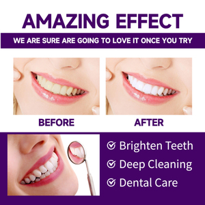 Poudre correctrice de couleur West Month Pure Fresh And Clean Teeth Tartar Très bien soin de la gomme buccale - Product Image 2