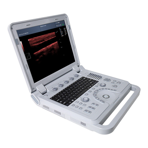 Alat USG Veteriner Mode B CMS600P2PLUS-VET 128G HDD Baterai Isi Ulang 2 Jam Pembentukan Sinar Digital Pencitraan Multifungsi - Product Image 2