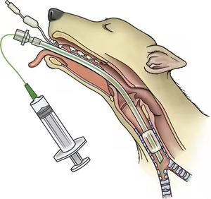 Yongyue tabung <span class=keywords><strong>Endotracheal</strong></span> yang diperkuat aman pabrik murah dengan Stylet 2.5-10mm trakea steril sekali pakai - Product Image 2