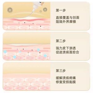 เฮชิ ไห่หนัวแผ่นเจลพิเศษสำหรับแผลในช่องปาก ครีมทาแผลในช่องปากและลิ้นอักเสบเพื่อส่งเสริมการสมานแผล 15 กรัม/หลอด - Product Image 3