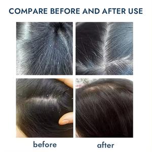 Gel <span class=keywords><strong>de</strong></span> tratamiento para eliminación <span class=keywords><strong>de</strong></span> <span class=keywords><strong>piojos</strong></span> vegano <span class=keywords><strong>de</strong></span> etiqueta privada, champú nutritivo 2 en 1, Control <span class=keywords><strong>de</strong></span> aceite, anticaspa, cuidado del cuero cabelludo, cuidado del cabello para adultos - Product Image 4