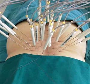 Dispositivo de fisioterapia de <span class=keywords><strong>acupuntura</strong></span> eléctrica TCM especializado equipo de Medicina China - Product Image 2